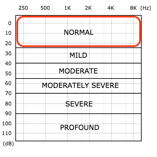 audiogram severity